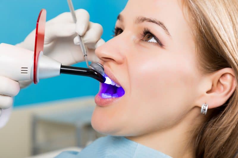 What Type of Tooth Fillings Are Best? Family Dentist and Denture Lab